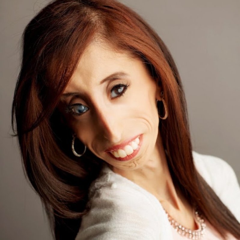 Lizzie Velasquez 