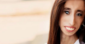 Lizzie Velasquez, 