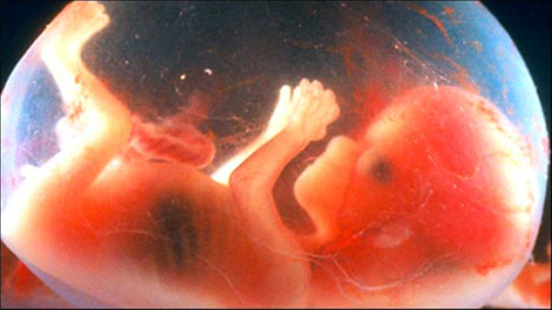 Unborn baby