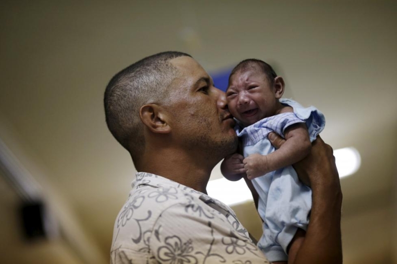 Zika virus and microcephaly among babies in Brazil