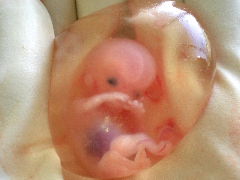 Human Fetus