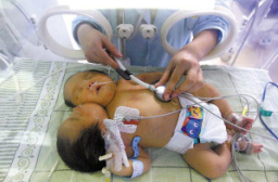 創世電視同工赴四川 領雙頭嬰一家信主