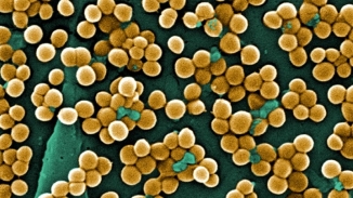 Potentially Deadly, Antibiotic Resistant 'SuperBugs' Now a Reality: WHO