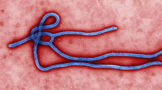 Ebola Virus Outbreak 2014: Signs, Symptoms, Prevention and Treatment