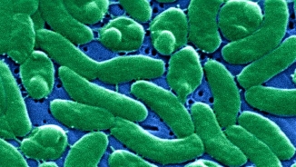 Flesh-Eating Bacteria Found in Florida Beach, Health Officials Issue Warning: 'Be Very Careful' 