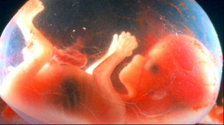 Woman Writes 'Heartbreaking' Open Letter To Unborn Baby Just Before Getting Abortion