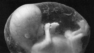 Feminist Aborts Baby Because He Was a Boy, Says 'I Couldn't Bring A Monster Into This World'