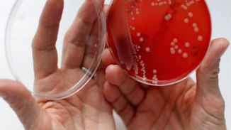 Scientists Find that Medieval Formula Can Kill Antibiotic-Resistant Bacteria MRSA Superbug 