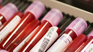 New Blood Test Has Ability to Detect Every Past and Present Virus Infection in a Person