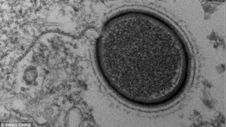 Scientists Discover Giant Monster Virus in Siberian Permafrost; Are Deadlier Viruses Laying Beneath?