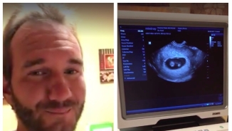 Limbless Evangelist Nick Vujicic Announces Wife is Pregnant With Twins: 'God is Good!'